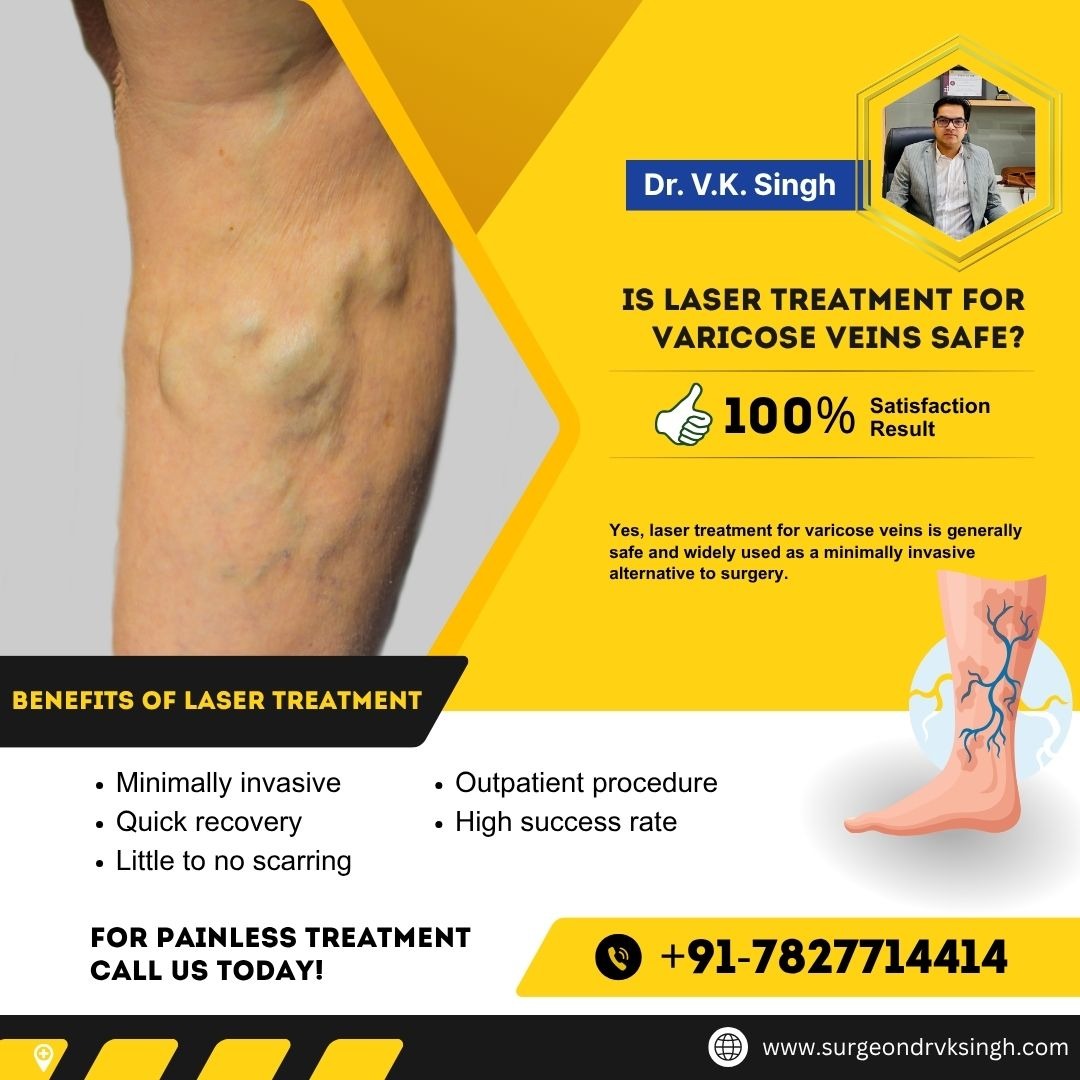 Is Laser Treatment for Varicose Veins Safe